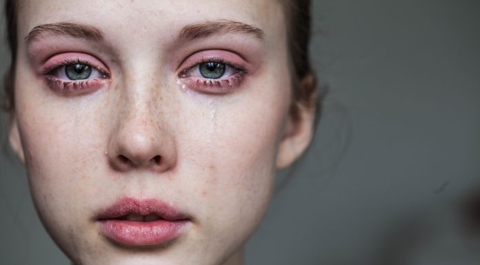 A close up of a woman's face, with red eyes swollen from crying