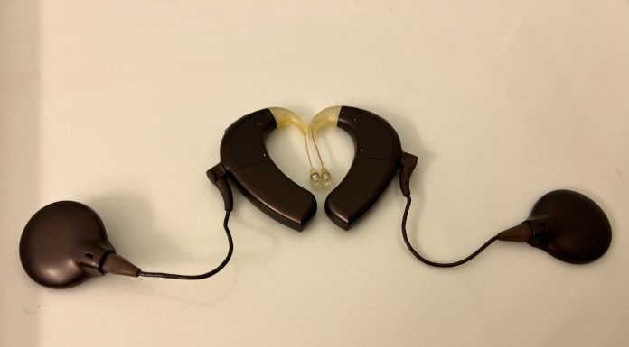 a pair of cochlear implants