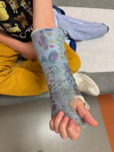 young child's arm and wrist in a blue cast with fingers sticking out. The cast is decorated with multicolored artwork and signatures drawn all over it.