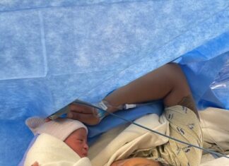 The Scar I Learned to Love: My C-Section Journey