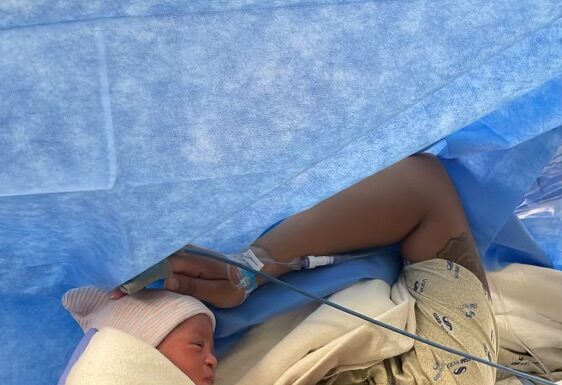 The Scar I Learned to Love: My C-Section Journey